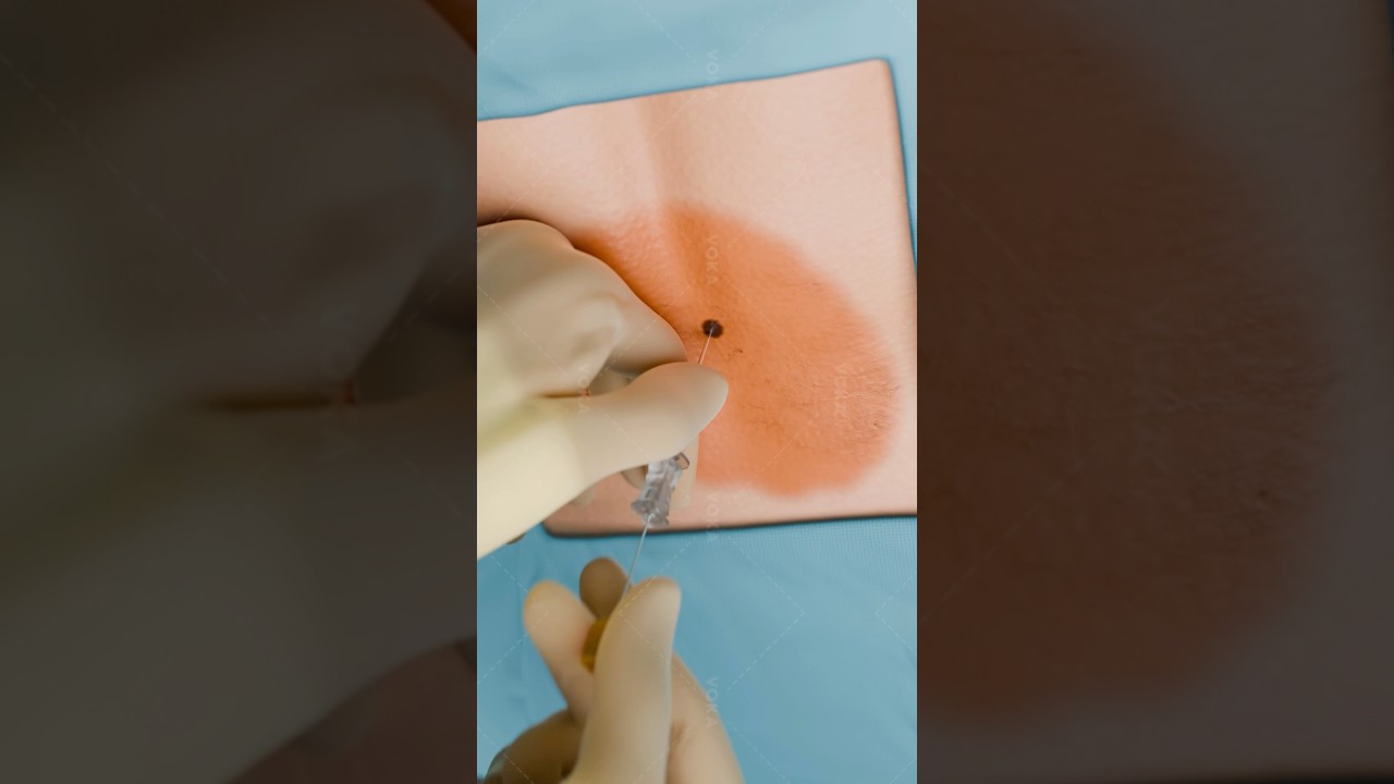 Imagen de marcador de posición youtube