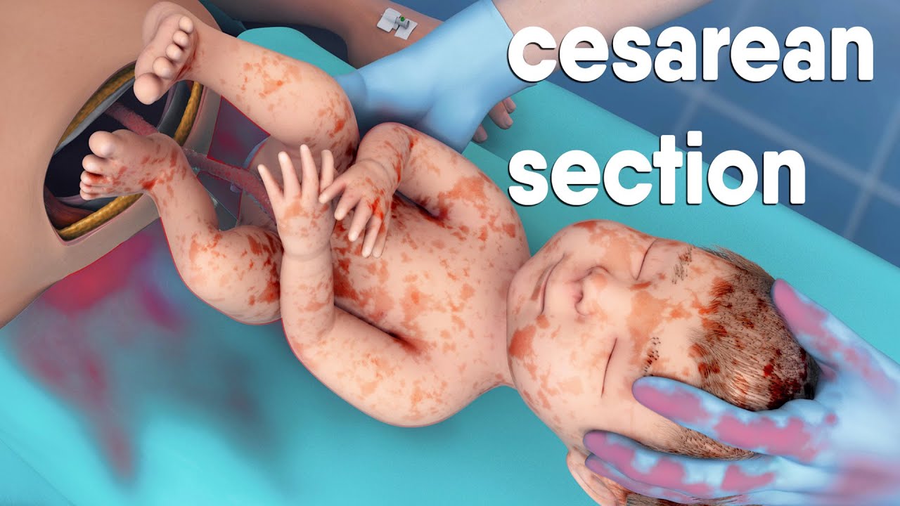 Immagine segnaposto youtube